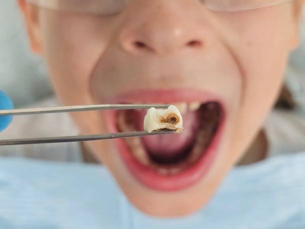 Best 24-Hour Emergency Dental Care in Rockfish, NC